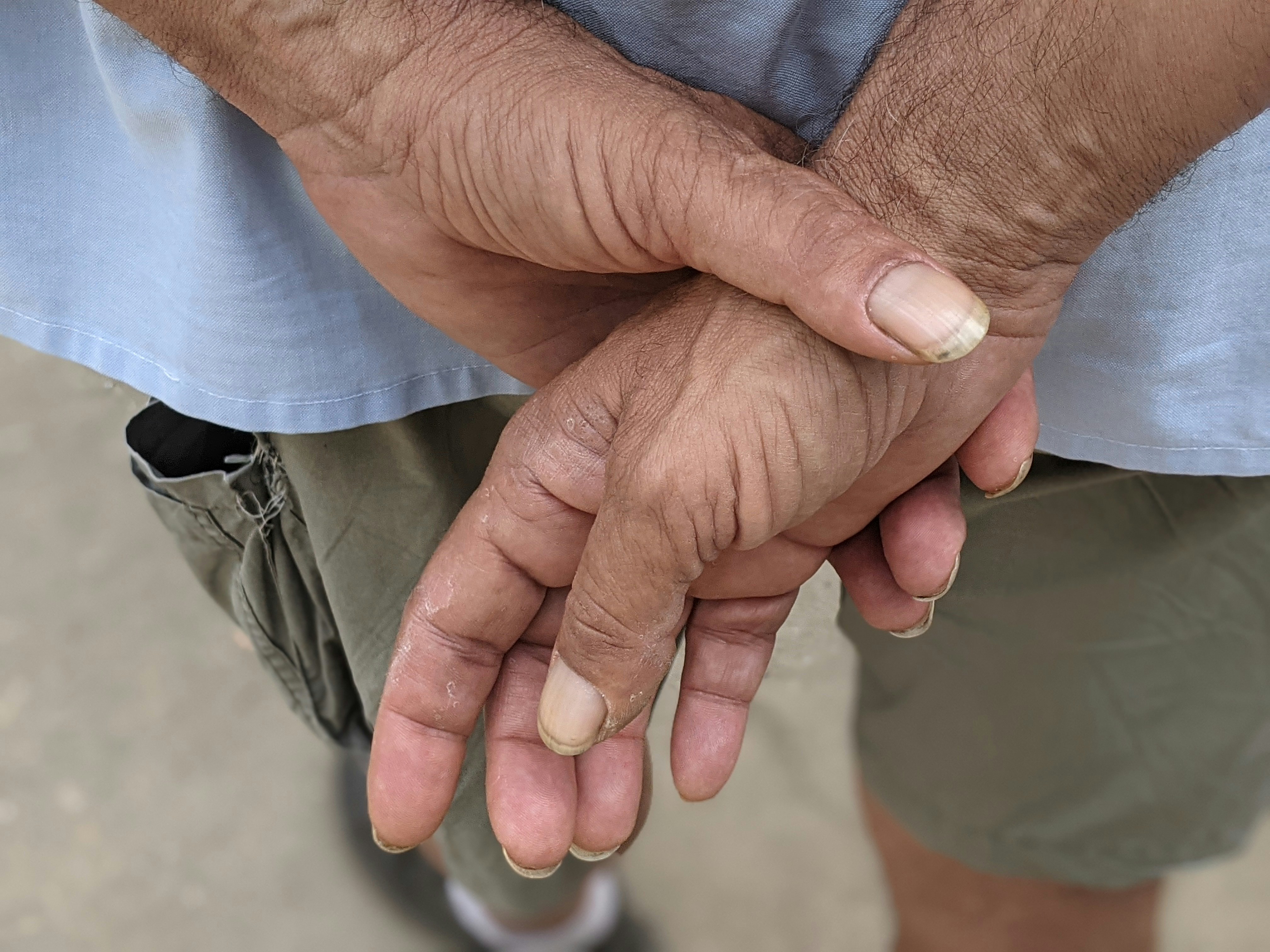 un gros plan d’une personne se tenant les mains jointes