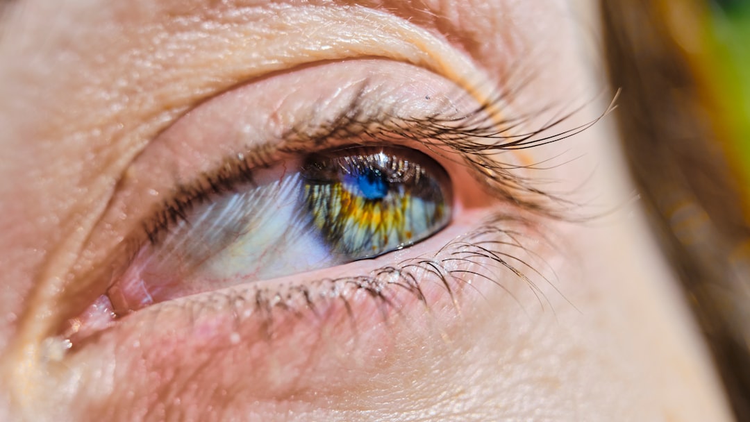 Cornea Transplant (Keratoplasty) in Tunisia