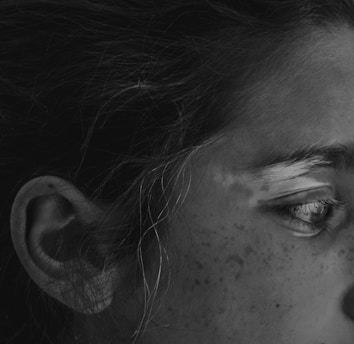A close-up of a person's face, focusing on the eye and part of the ear. The skin is detailed with freckles, and the eyelashes and eyebrow hair are visible. The image is black and white, highlighting textures and contrasts.