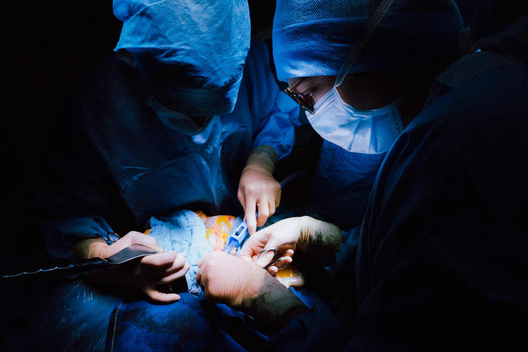 Cardiac catheterization lab with dim blue lighting, surgeons in silhouette