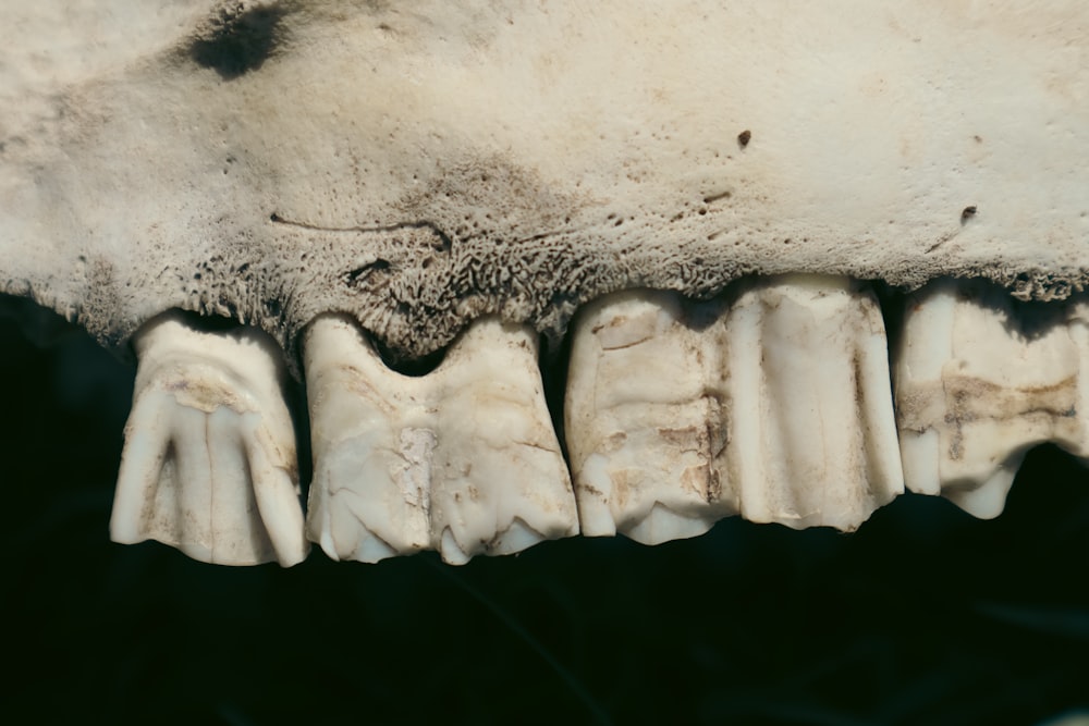 a close up view of a tooth with a missing tooth