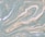 a marble pattern with a pastel blue and beige color scheme