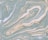a marble pattern with a pastel blue and beige color scheme