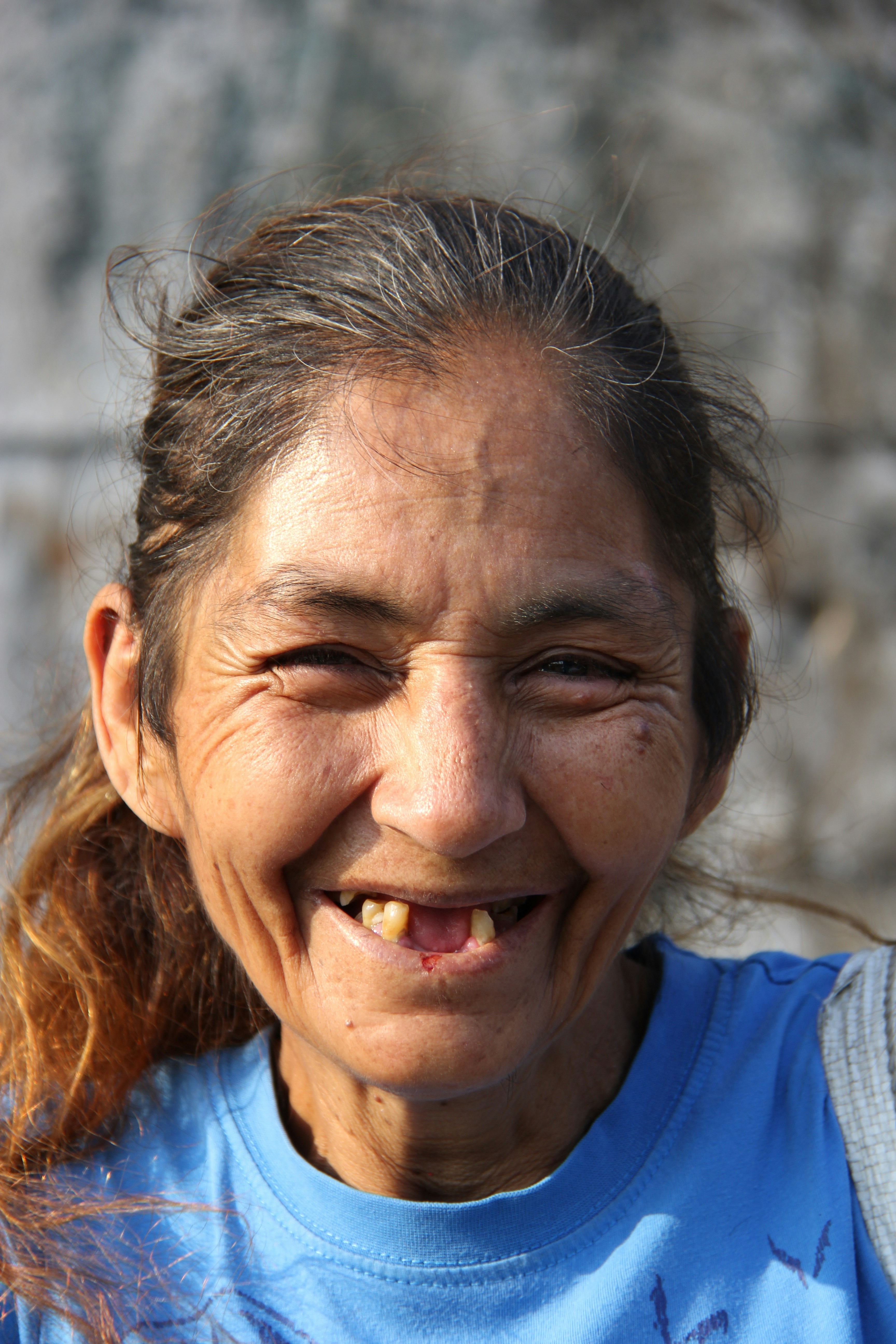 a woman with a tooth missing and a toothbrush in her mouth