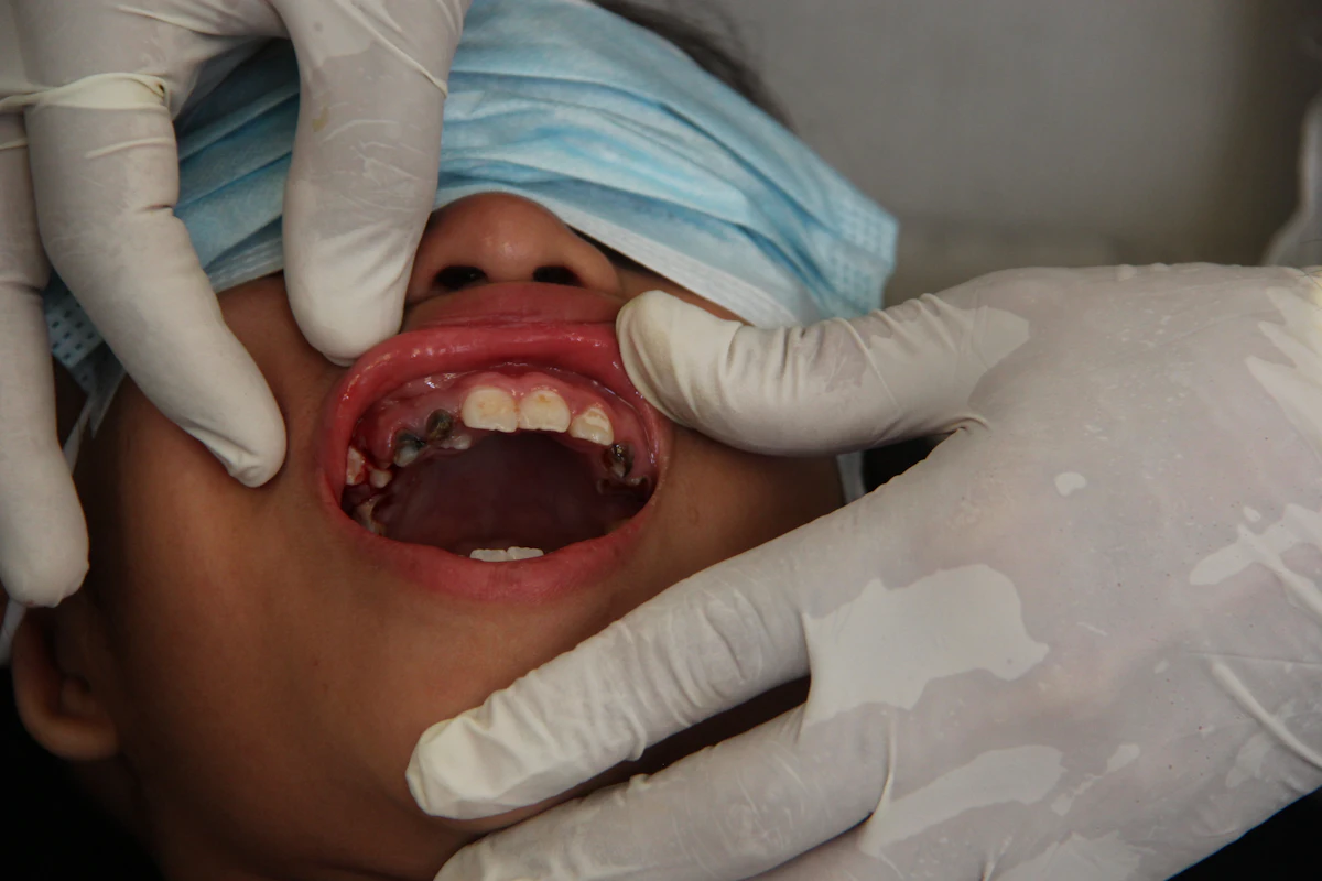 İllüstratif görsel: a woman getting her teeth checked by a dentist