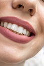 a close up of a woman's mouth with white teeth