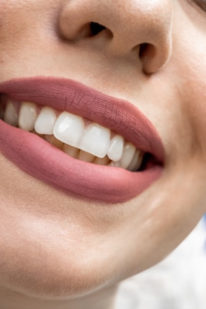 a close up of a woman's mouth with white teeth