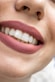 a close up of a woman's mouth with white teeth