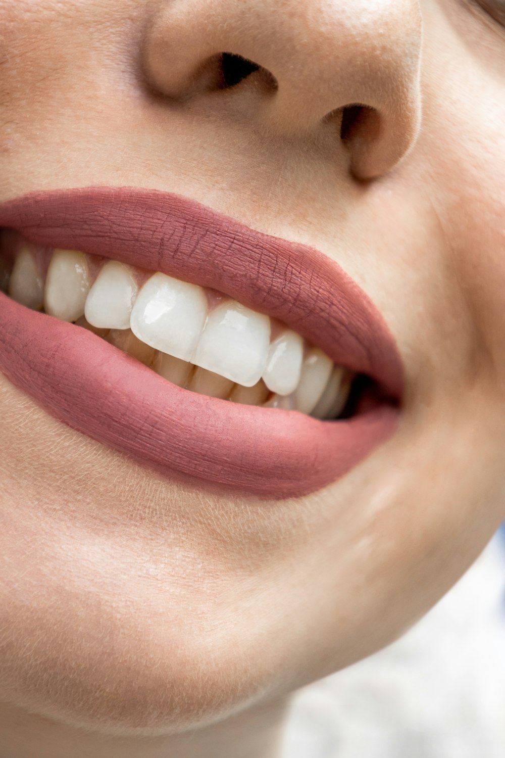 a close up of a woman's mouth with white teeth