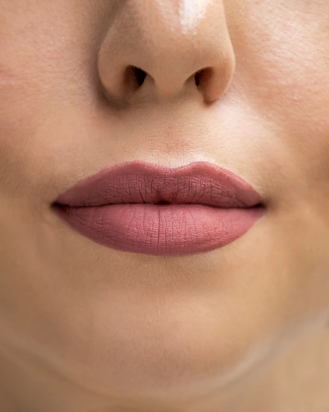 Close-up of a woman's lips and nose showing natural facial volume and contour, representing the areas addressed by dermal filler treatments