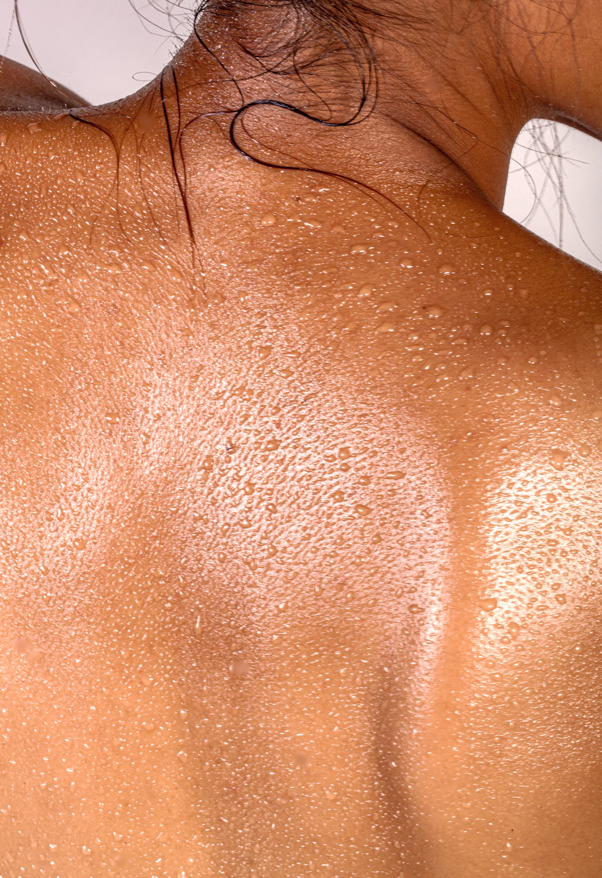 Close-up of the back of a head with visible scalp condition, representing scalp infection management