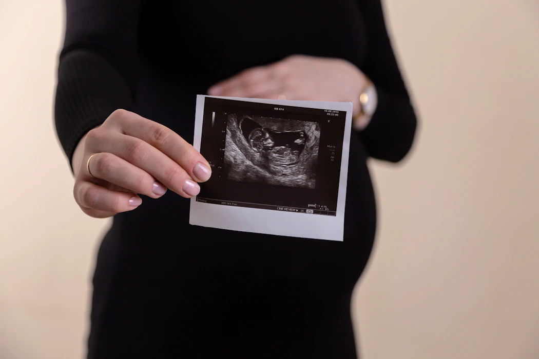 Pregnant woman holding ultrasound scan