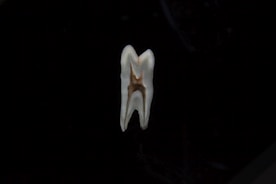 a white jellyfish in the dark