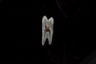 a white jellyfish in the dark