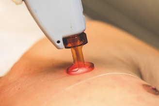 A close-up shot of a device being used on skin, featuring a transparent orange suction cap attached to a white handheld machine. The image provides a detailed view, focusing on the interaction between the device and the skin.