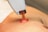 A close-up shot of a device being used on skin, featuring a transparent orange suction cap attached to a white handheld machine. The image provides a detailed view, focusing on the interaction between the device and the skin.