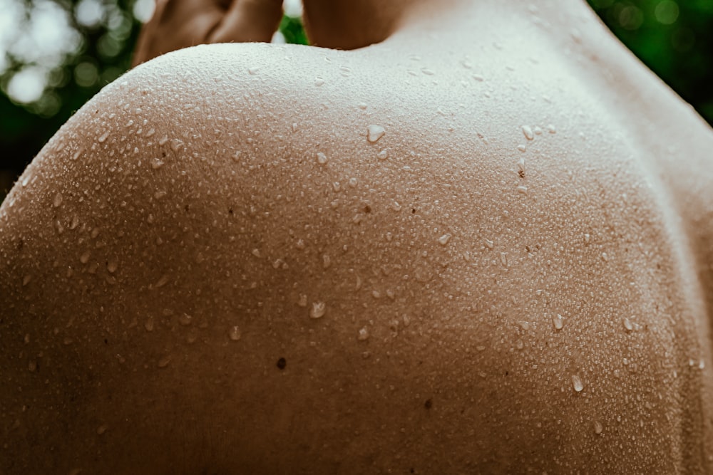 a close up of a person's skin