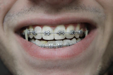close-up of a person's mouth