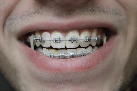 close-up of a person's mouth