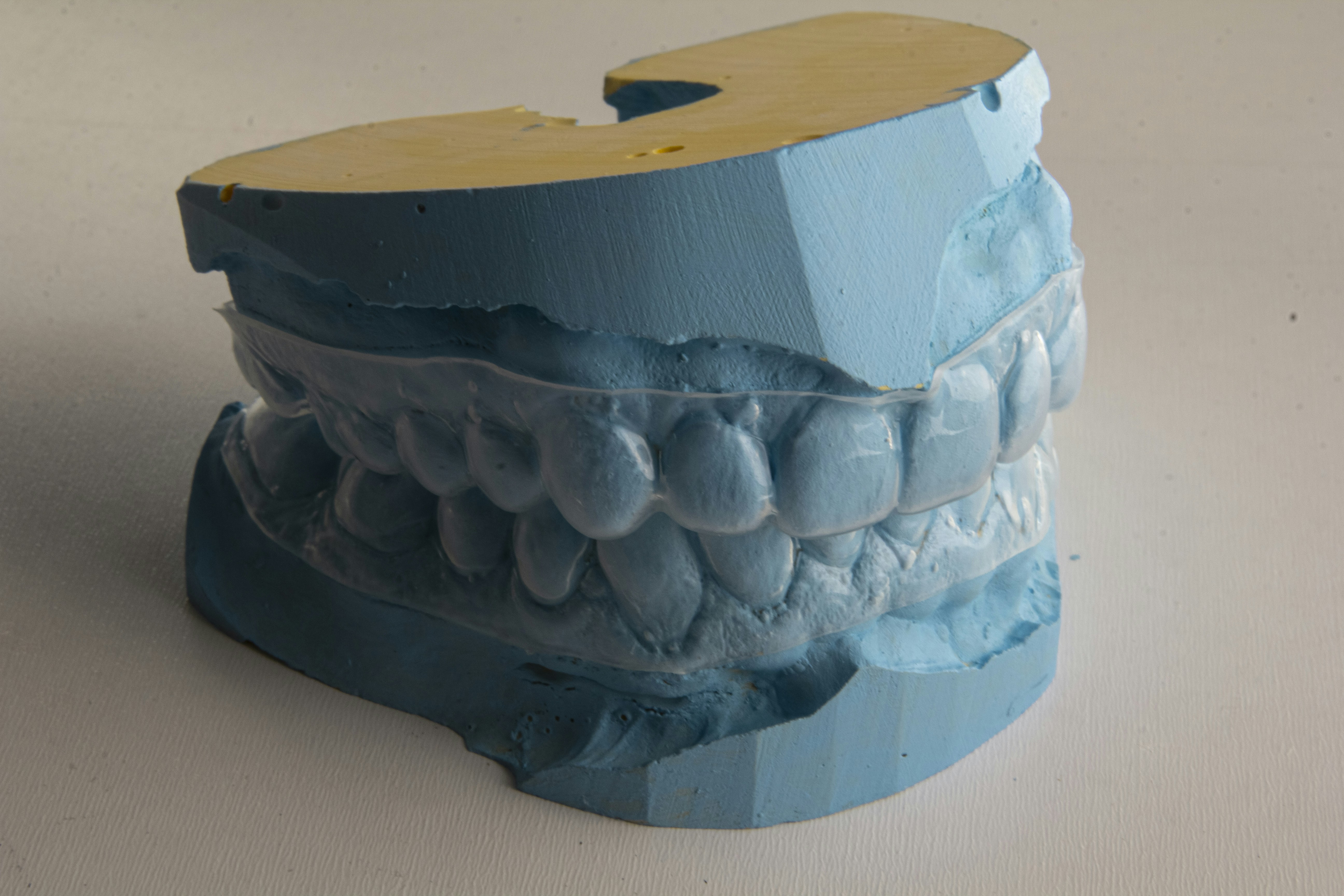 Dental Implant Hartford OH