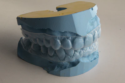 Thin clear plastic tray fitted over a blue dental model on beige