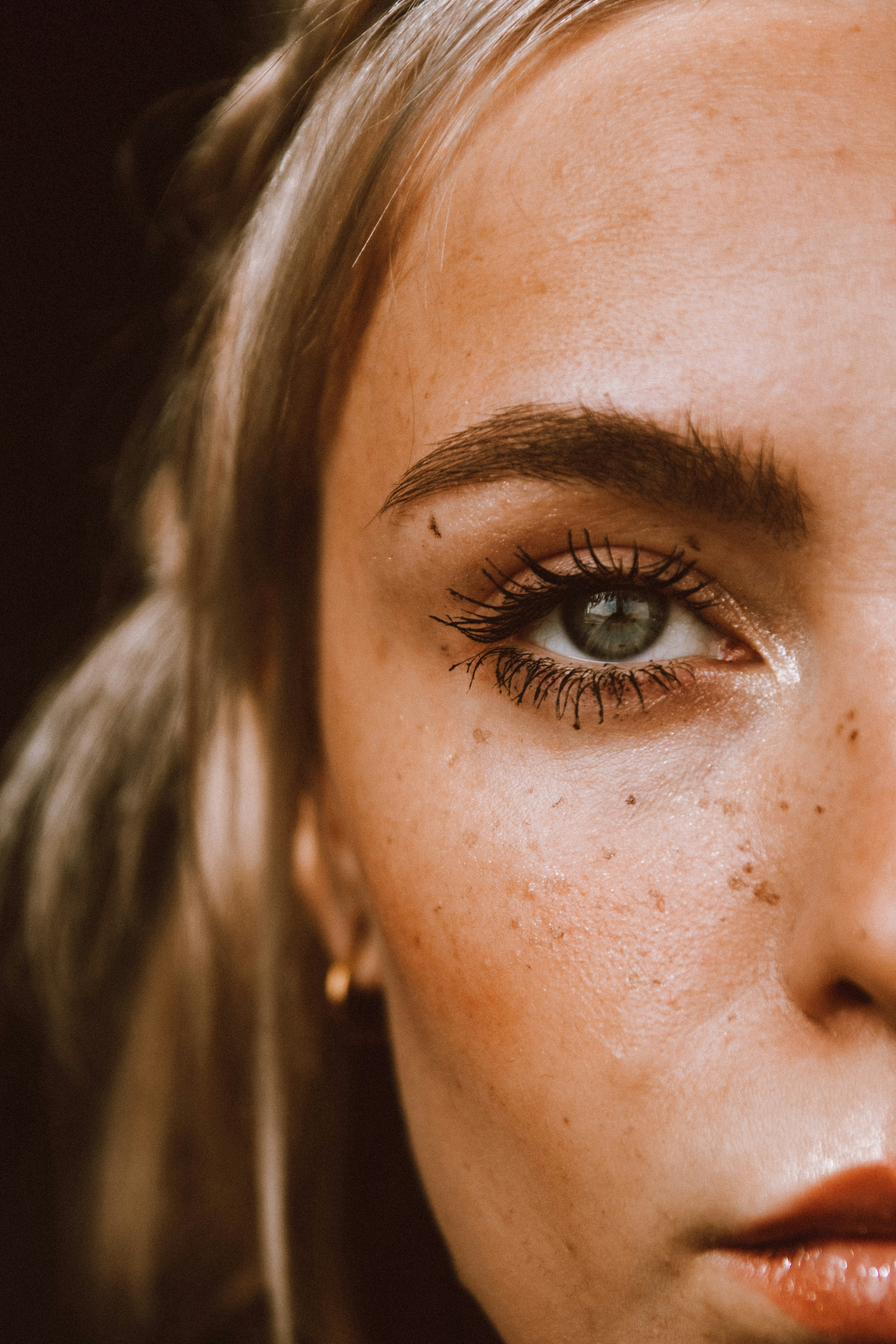 Una persona con un occhio nero