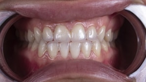 a close up of a bowl