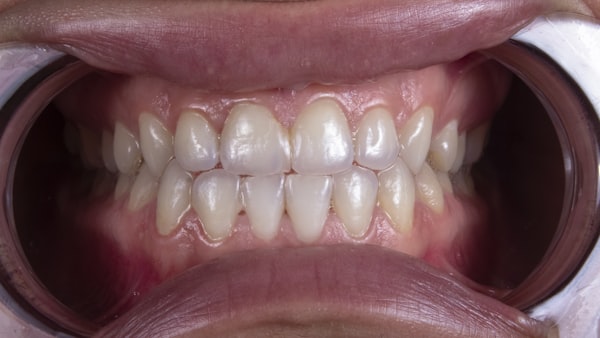 Consultation + Diagnostic