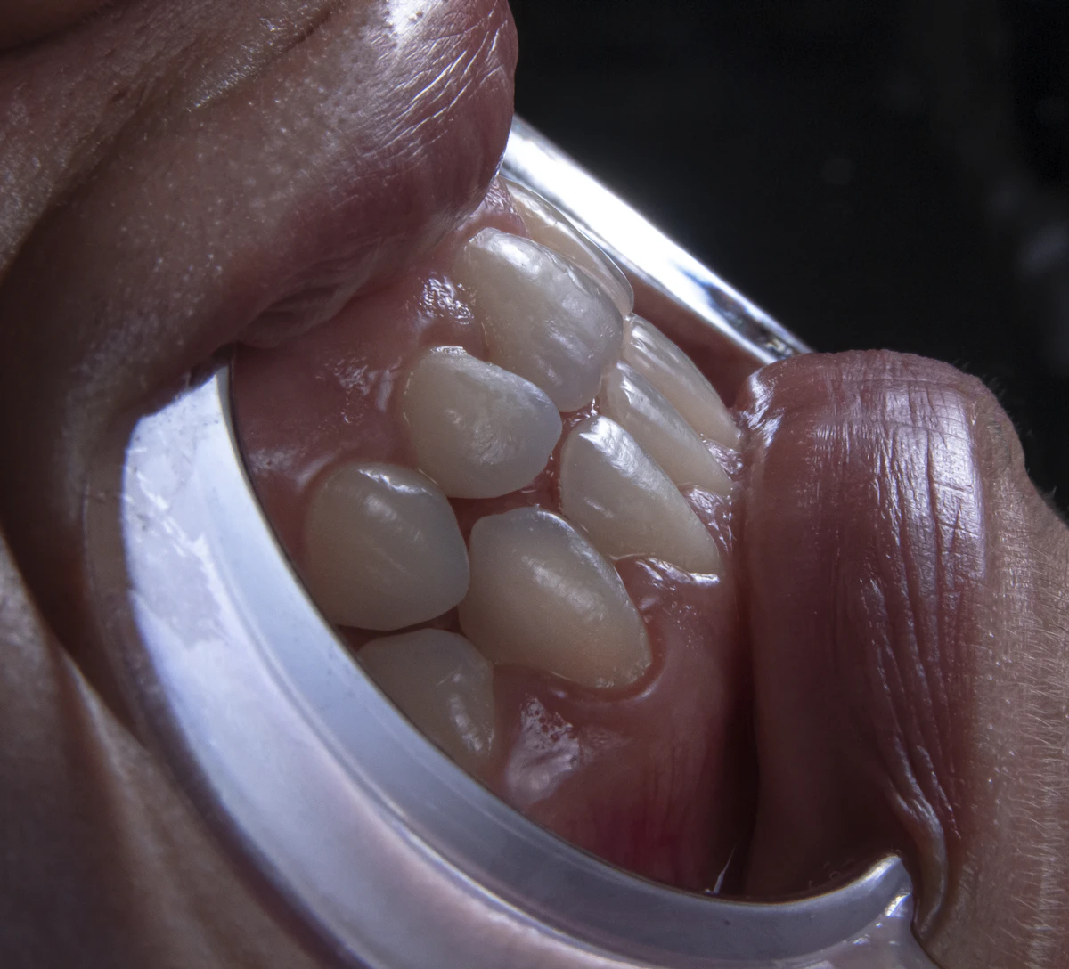 İllüstratif görsel: a person's mouth with teeth