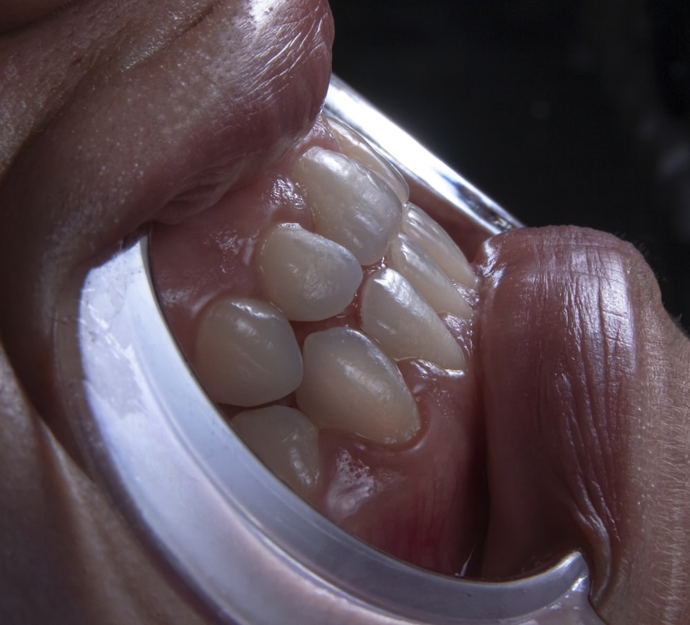 boca de uma pessoa com dentes