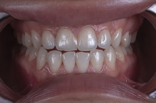 a close up of a bowl