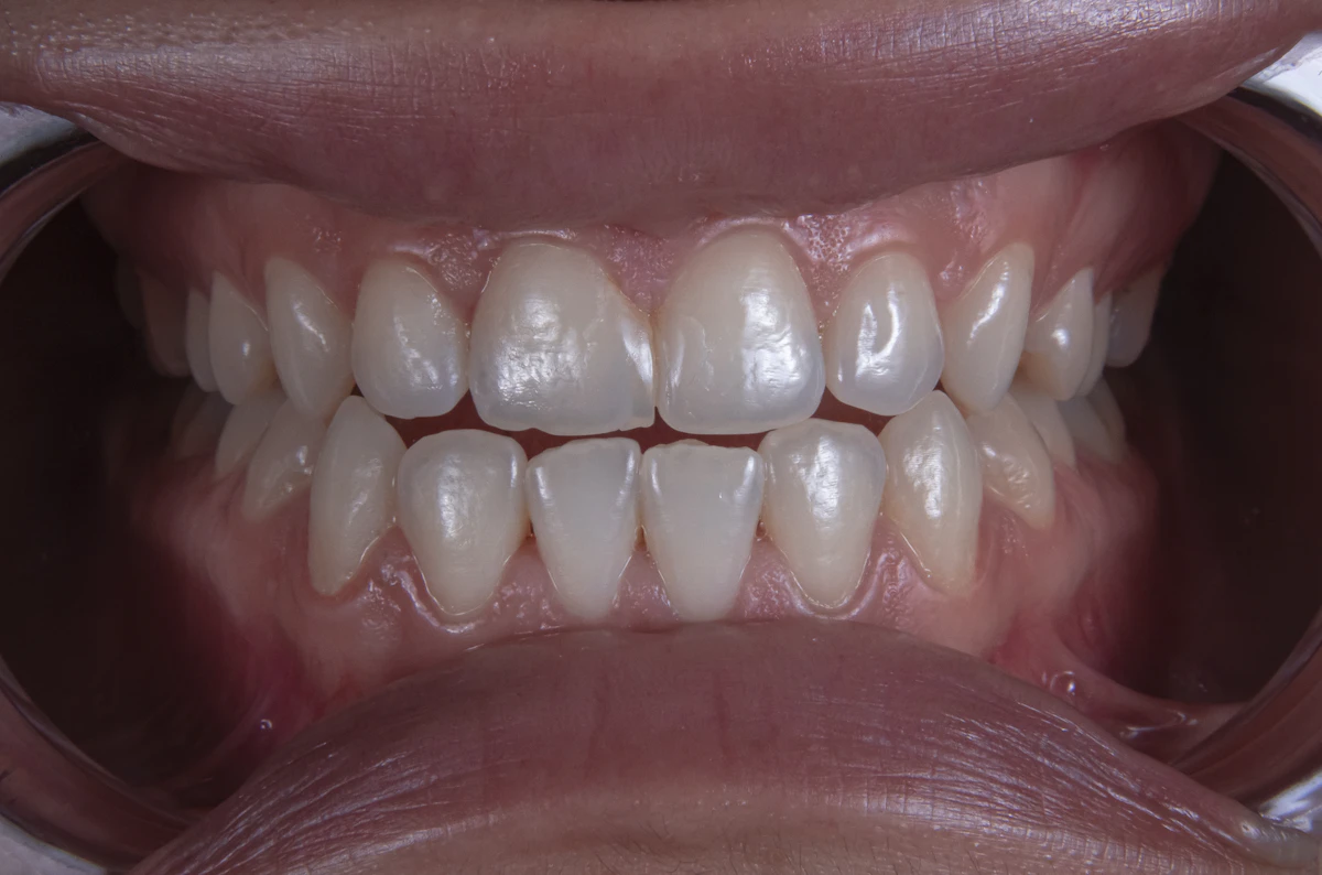 Proposal Generation for Dental Practices Cuts 6 Hours/Week 2026