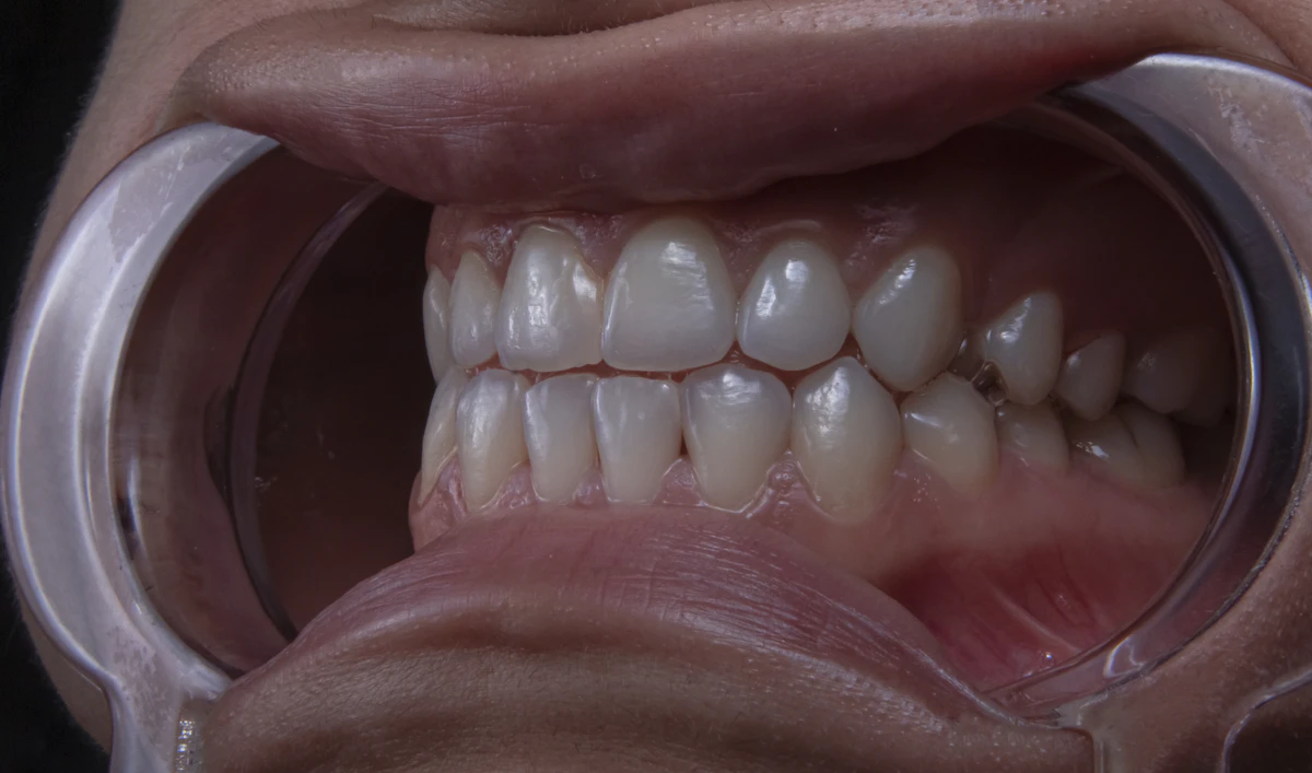 Is Referral Software Worth It for Dental Practices in 2026?