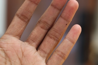 Close-up of a mole removal procedure being gently performed on skin.