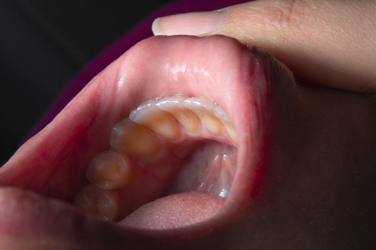 İllüstratif görsel: a person holding a baby's mouth