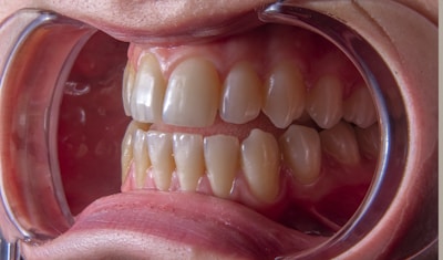 a close-up of a person's mouth