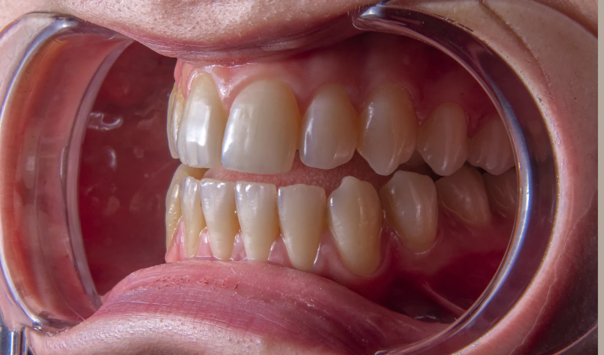 İllüstratif görsel: a close-up of a person's mouth