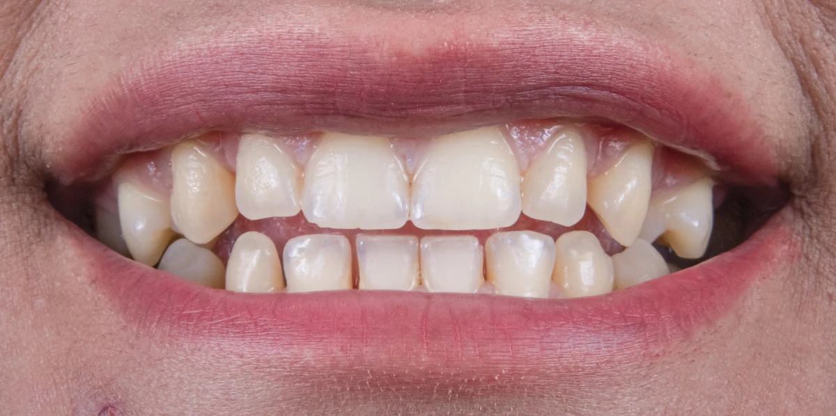 5 Steps to Automate Text Follow-Up for Dental Practices 2026