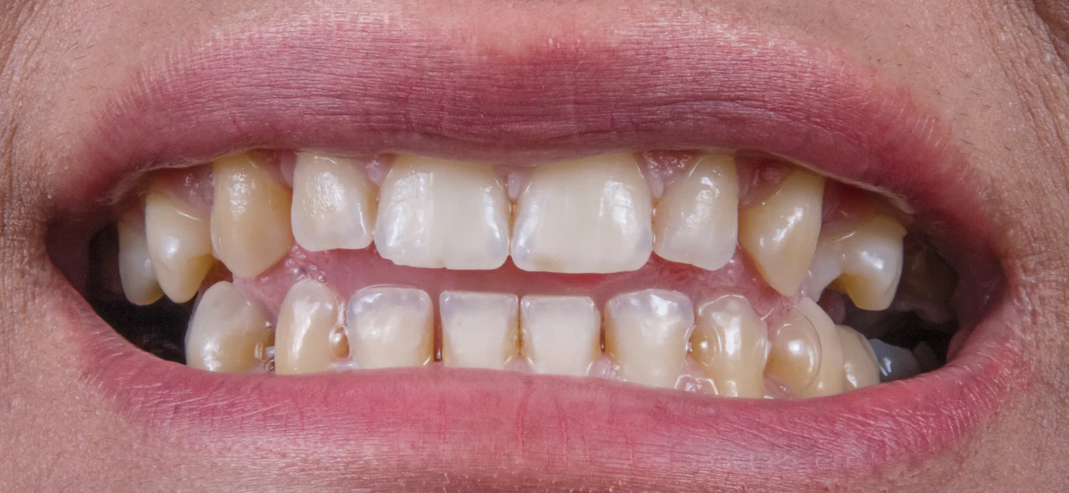 Consolidate Dental Lead Follow-Up Into 3 Workflows 2026