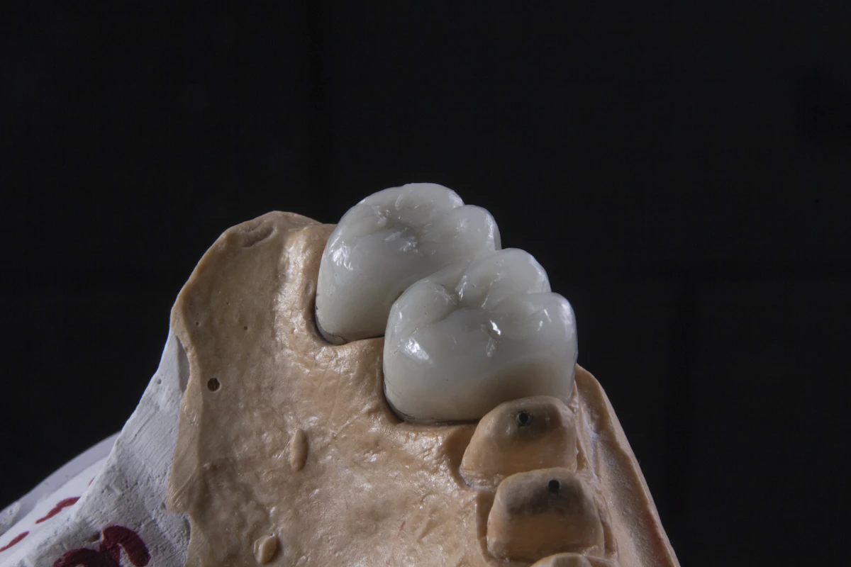 How Dental Recall Adds $20K Monthly in 2026