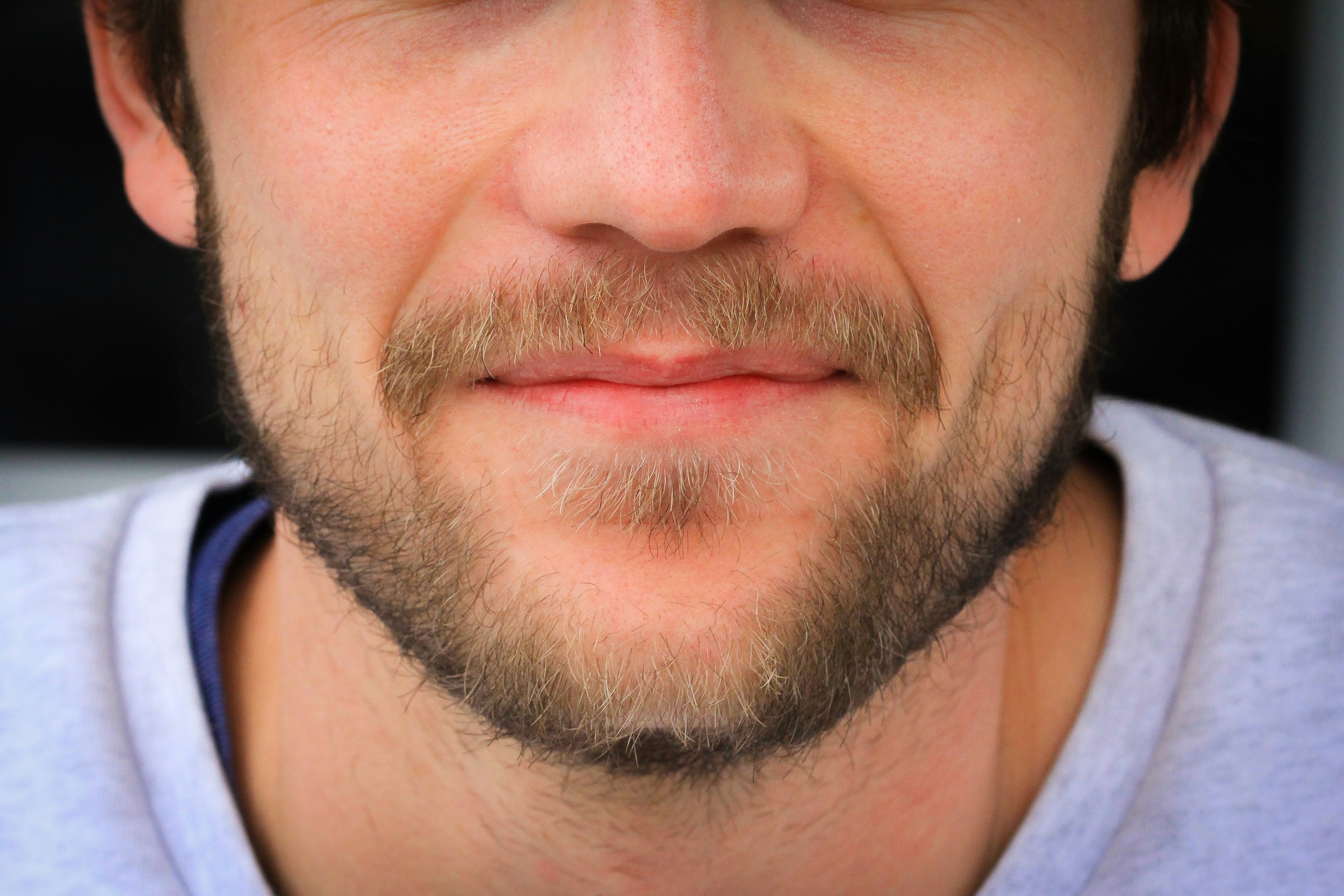 Have you started experiencing facial hair growth?