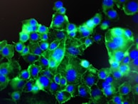 A close-up view of cells under a fluorescent microscope, showing bright green and blue colors. The cells have distinct blue nuclei surrounded by an irregular green cytoplasm, all set against a dark background.