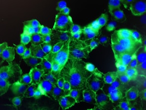 A close-up view of cells under a fluorescent microscope, showing bright green and blue colors. The cells have distinct blue nuclei surrounded by an irregular green cytoplasm, all set against a dark background.