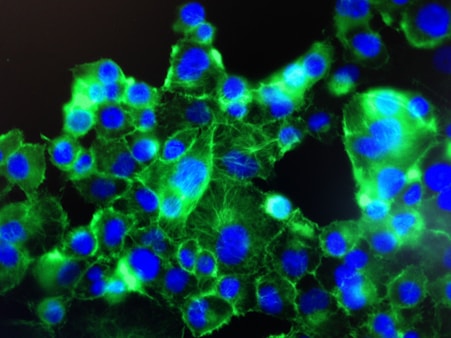 A close-up view of cells under a fluorescent microscope, showing bright green and blue colors. The cells have distinct blue nuclei surrounded by an irregular green cytoplasm, all set against a dark background.