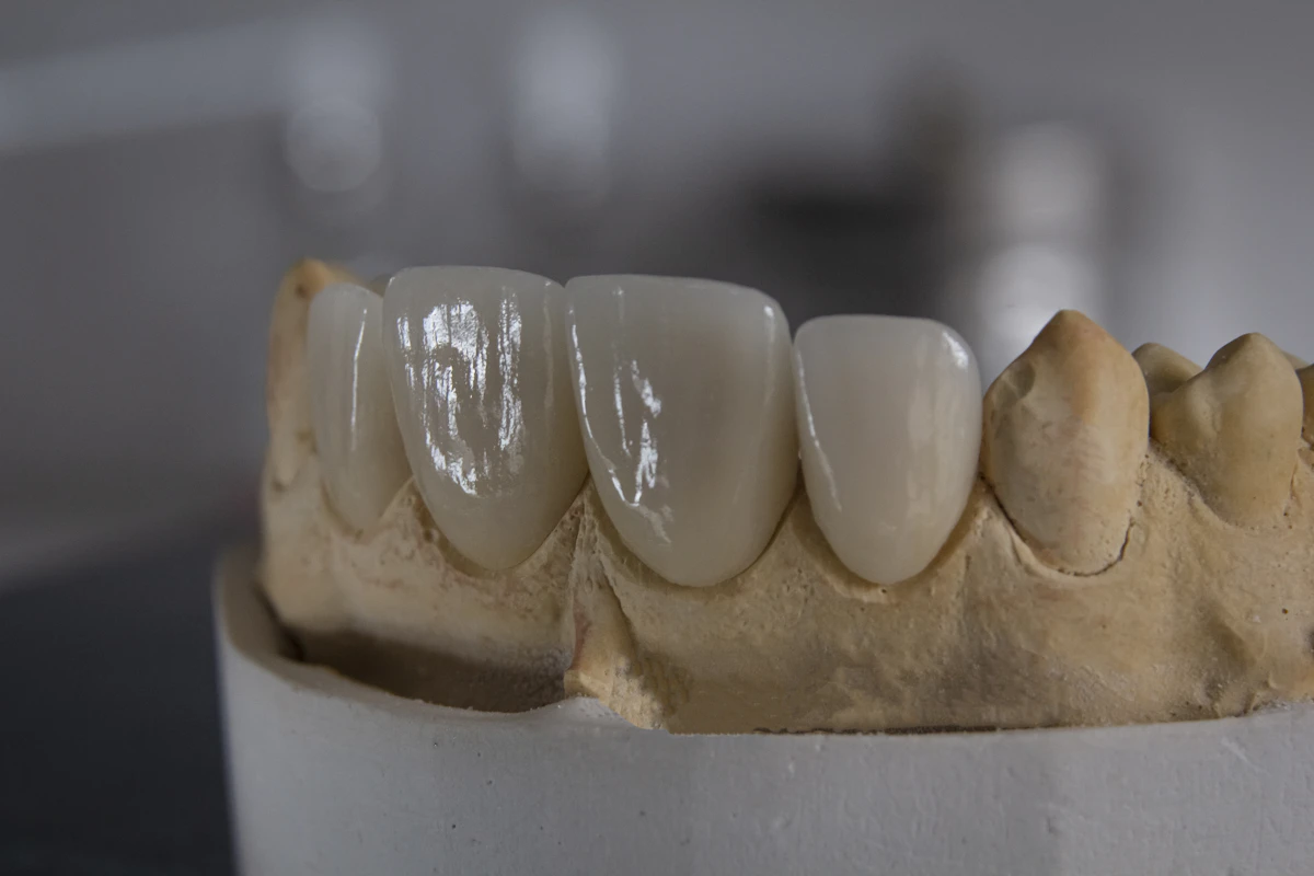 7 Steps to Win-Back Campaigns for Dental in 2026