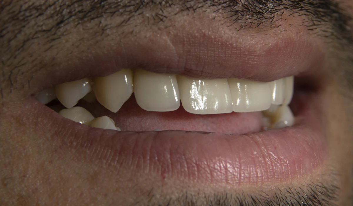 İllüstratif görsel: a close up of a person's mouth