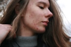 a woman with a substance on her face