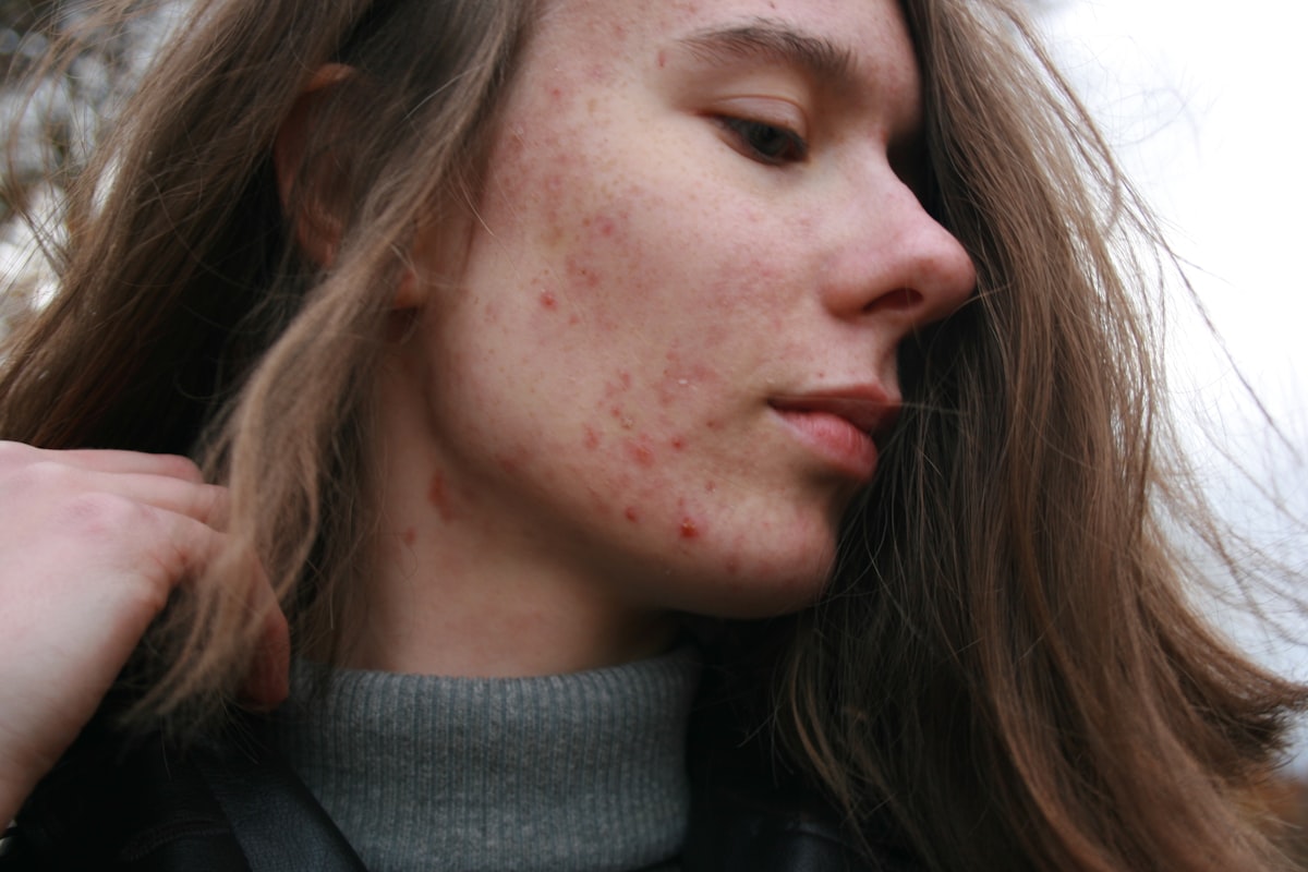 A person with a treatment product applied across the face
