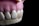 A close-up view of a dental model showcasing a row of artificial teeth with pale pink gums. A dental veneer is partially attached to one of the front teeth.