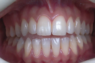 a person's mouth with teeth